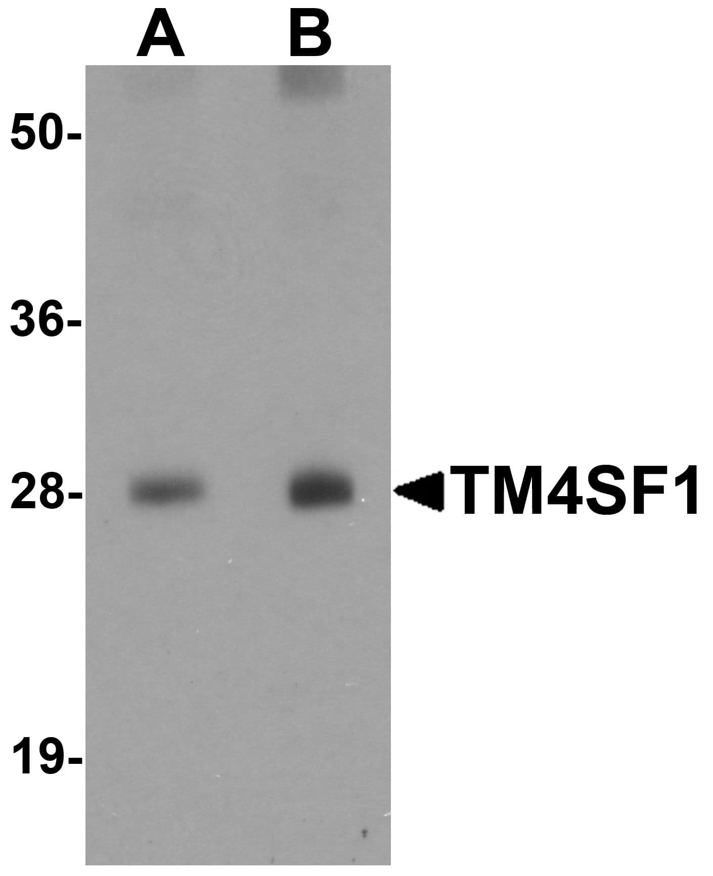 IHC-plus™ Polyclonal Rabbit anti-Human TM4SF1 Antibody (IHC, IF, WB)