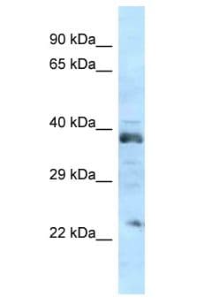 ATOH1 / MATH-1 Antibody (aa8-57)