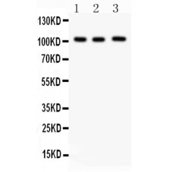 ITCH / AIP4 Antibody (aa410-437)