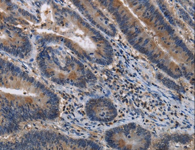 ITPR2 / IP3 Receptor Type 2 Antibody