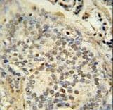 FUS / TLS Antibody (aa499-526)