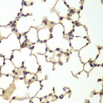 USF1 / USF Antibody