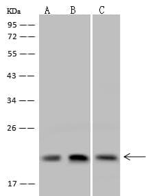 Dynactin 3 / DCTN3 Antibody