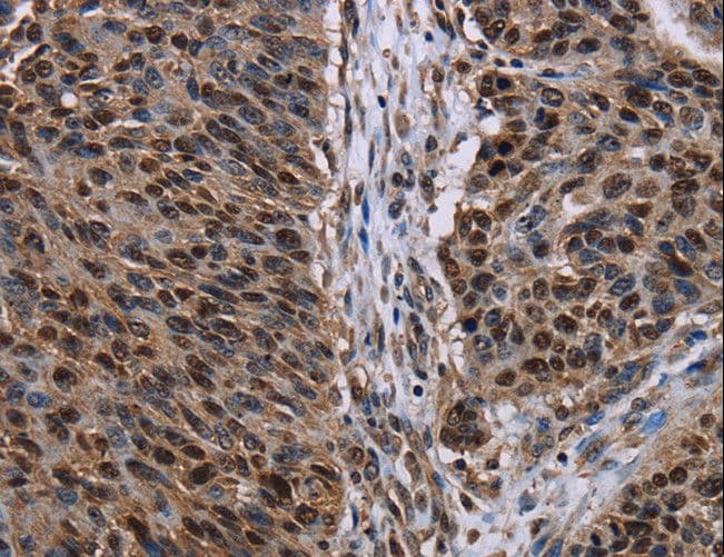Polyclonal Rabbit anti-Human KDM3B / JMJD1B Antibody (IHC)