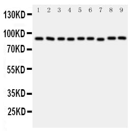 Polyclonal Rabbit anti-Human VCP Antibody (aa749-766, IHC, WB)