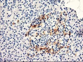 TP73-AS1 / KIAA0495 Antibody (clone OTI2A9, Carrier-free)