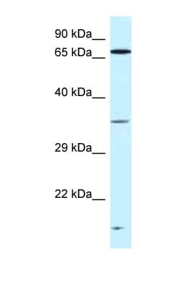 Polyclonal Rabbit anti-Human VPS26A / VPS26 Antibody (C-Terminus, WB)