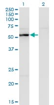 UAP1 Antibody (clone 3A9)