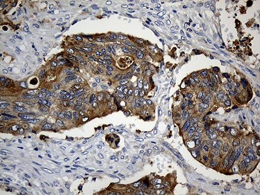 CIB1 / KIP Antibody (aa2-191, clone OTI1B8)