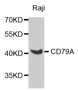 CD79A / CD79 Alpha Antibody