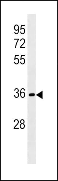 RFPL3 Antibody (aa70-98)