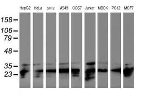 PSMB7 Antibody (aa58-277, clone OTI4E3)