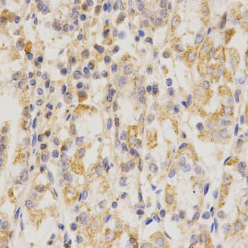 Polyclonal Rabbit anti-Human CD151 Antibody (IHC, WB)