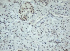 CBX8 Antibody (clone OTI3D1)
