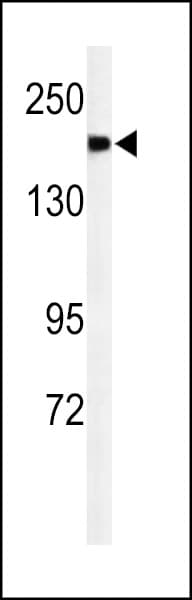 A2ML1 Antibody (aa345-373)