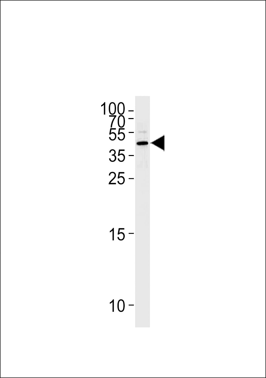 SERPINB5 / Maspin Antibody (aa94-123)