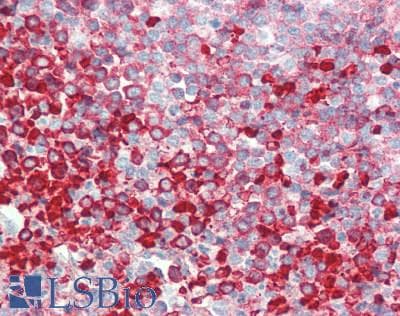 Polyclonal Rabbit anti-Human IL1RL1 Antibody (aa357-532, IHC, WB)
