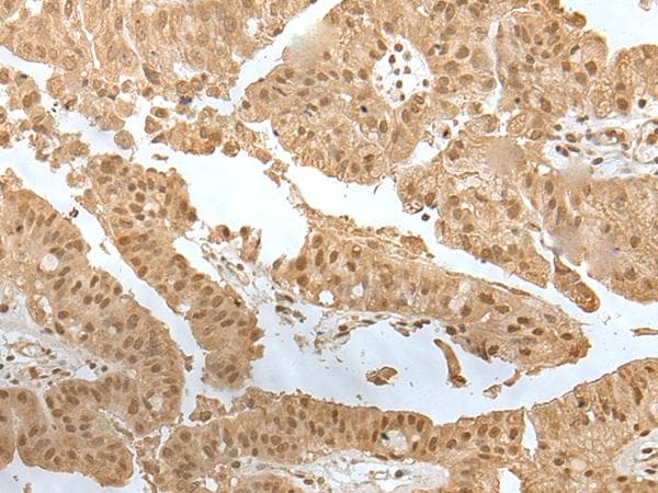 ZNF191 / ZNF24 Antibody