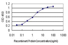IHC-plus™ ARRB2 / Beta Arrestin 2 Antibody (clone 3G1)