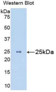 MASP2 / MASP-2 Antibody (aa22-142, Biotin)
