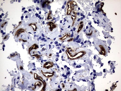 MCAM / CD146 Antibody (clone OTI5C4)