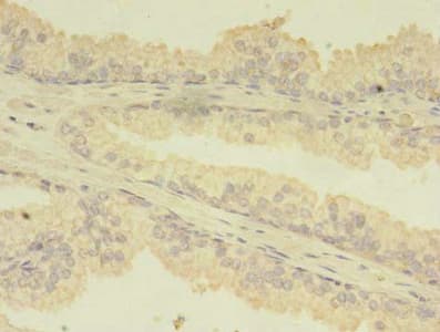 Polyclonal Rabbit anti-Human TBCA Antibody (IHC)
