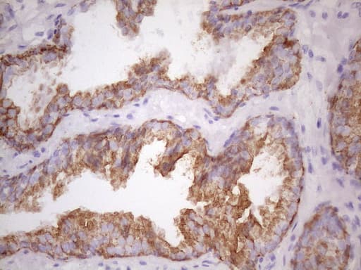 KRT16 / CK16 / Cytokeratin 16 Antibody (clone 7A4, Carrier-free)
