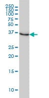 IHC-plus™ NMI Antibody (clone 9D8)