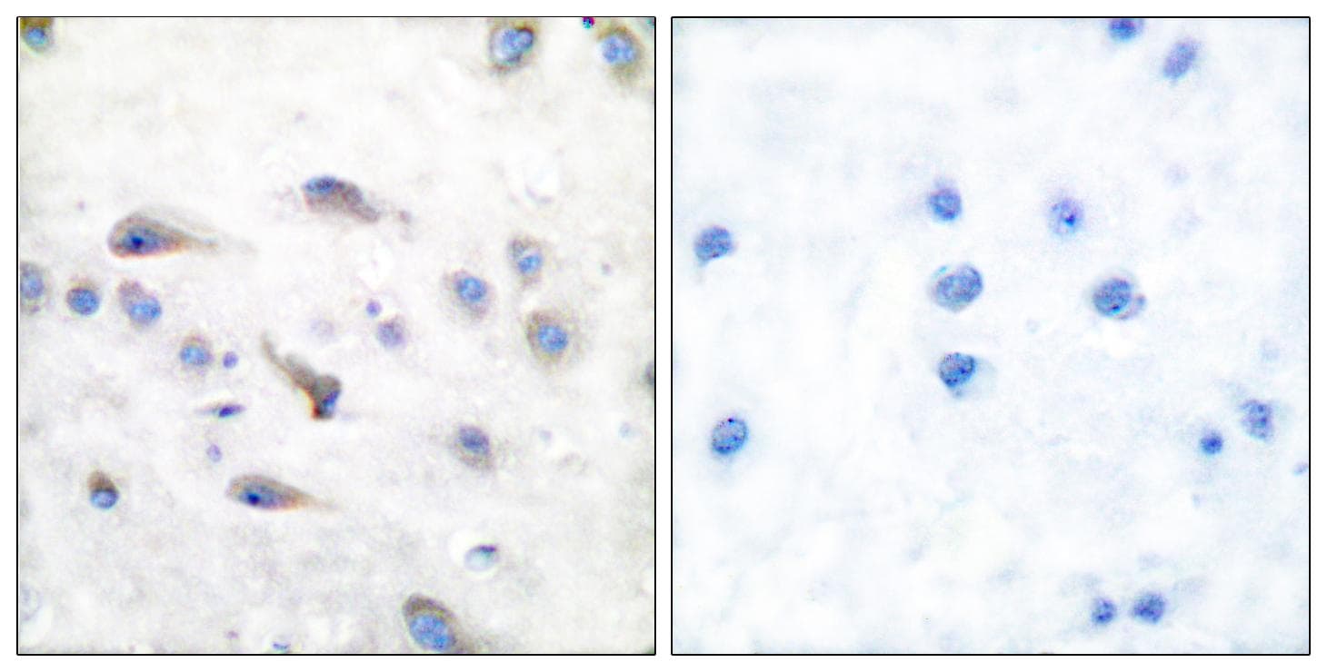 Polyclonal Rabbit anti-Human MAP3K8 / TPL2 Antibody (phospho-Thr290, IHC, IF, WB)