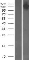 SYMPK / Symplekin Protein (Over-Expression Lysate Myc-DDK (Flag))