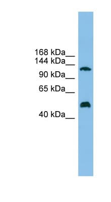 Polyclonal Rabbit anti-Human GART / GARS Antibody (aa791-840, WB)