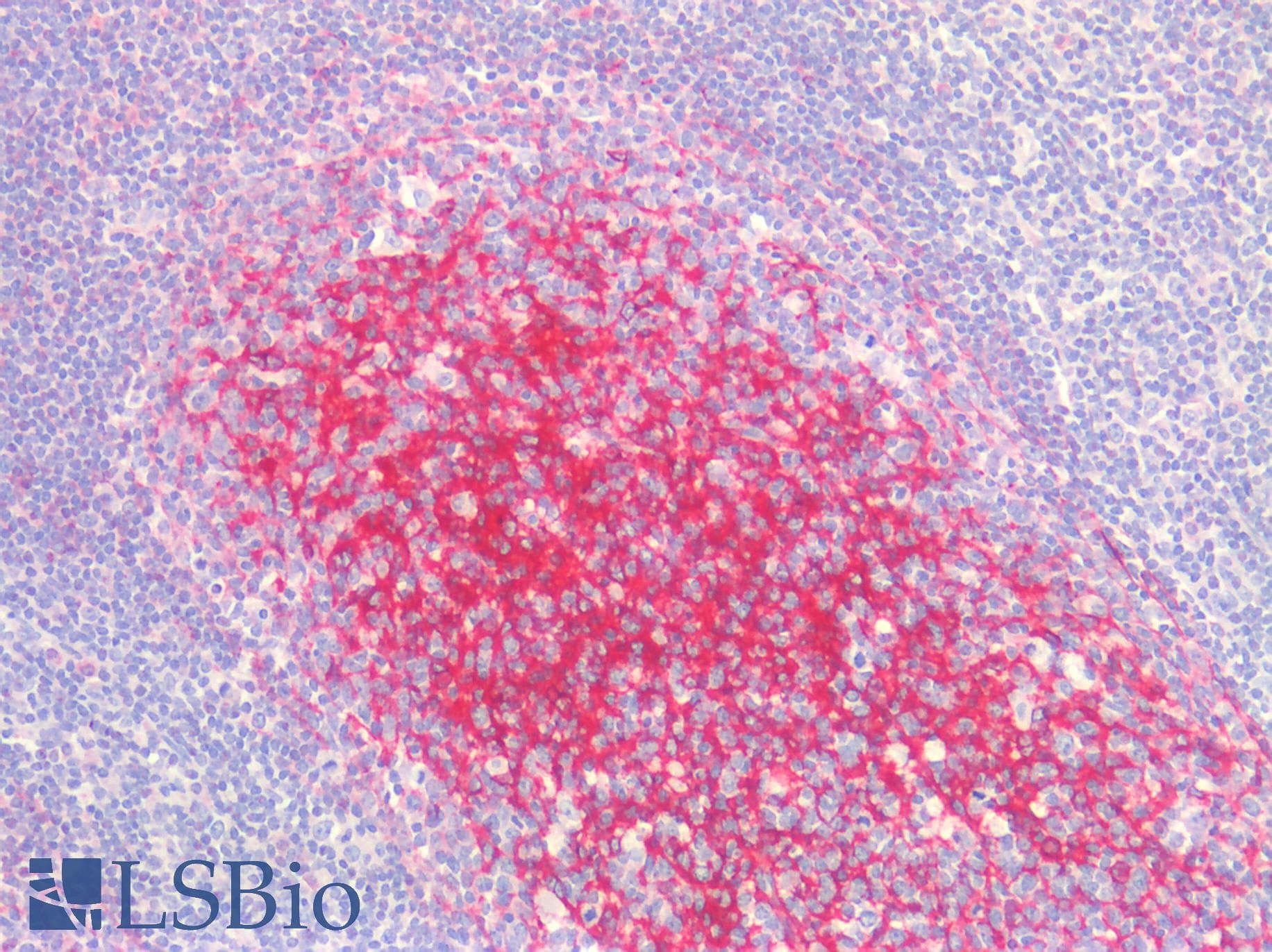 IHC-plus™ CLU / Clusterin Antibody (aa488-501)