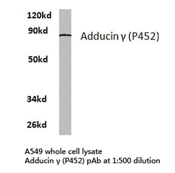 Polyclonal Rabbit anti-Human ADD3 Antibody (Pro452, IHC, IF, WB)
