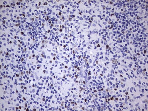 Monoclonal Rat anti-Human MKI67 / Ki67 Antibody (clone OTI3A11, aa1160-1493, IHC)