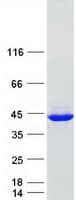 Human DCPS Protein (Recombinant Myc-DDK (Flag))