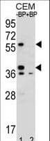MNDA Antibody (aa26-53)