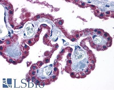 PathPlus™ CCKBR / Cckb Antibody (Extracellular Domain)