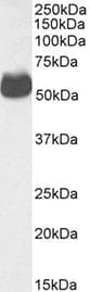 SLC2A4 / GLUT-4 Antibody