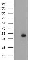 P5CR2 / PYCR2 Antibody (clone OTI2A12, Carrier-free)