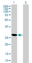 Monoclonal Mouse anti-Human CDK4 Antibody (clone 4F11, IF, WB)