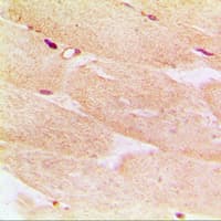 ACTA1 / Skeletal Muscle Actin Antibody (N-Terminus)
