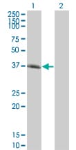 SPI1 / PU.1 Antibody (clone 1A3)