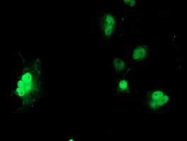 LSM1 Antibody (clone OTI5E6)