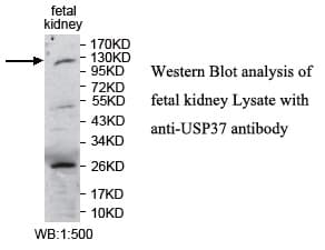 USP37 Antibody (aa2-217)