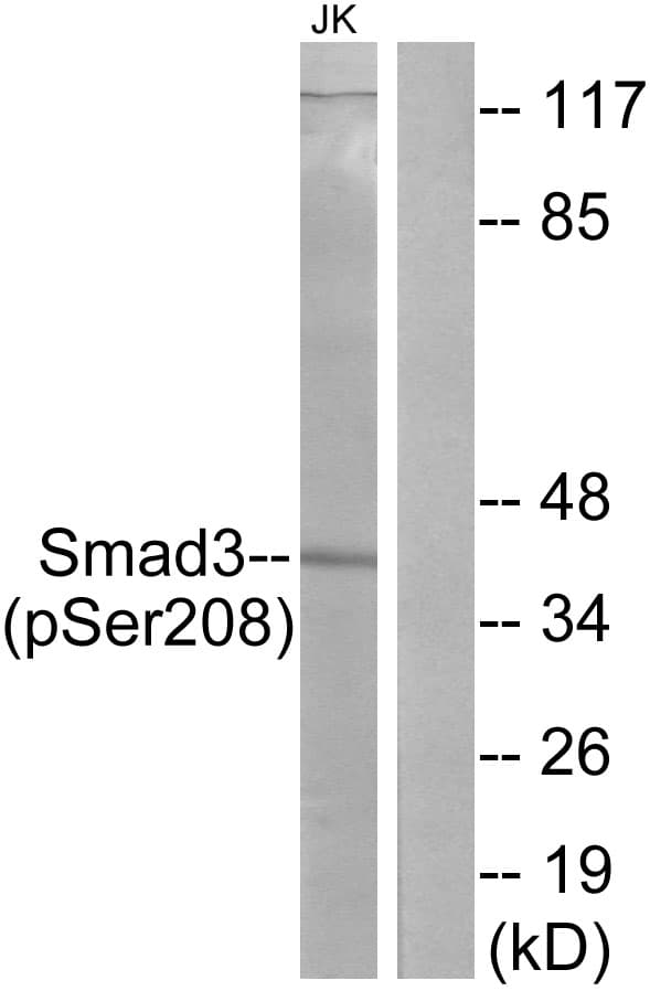 Polyclonal Rabbit anti-Human SMAD3 Antibody (aa 174-223, IHC, WB)