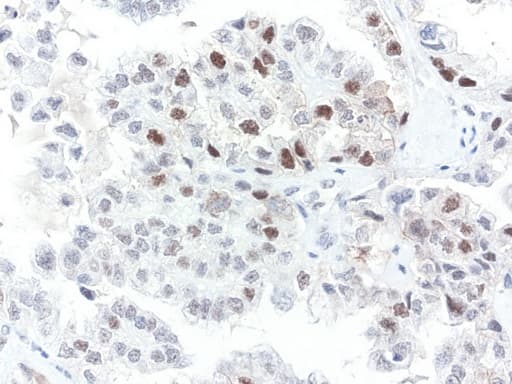 Monoclonal Mouse anti-Human ERCC4 / XPF Antibody (clone UMAB22, IHC, IF)