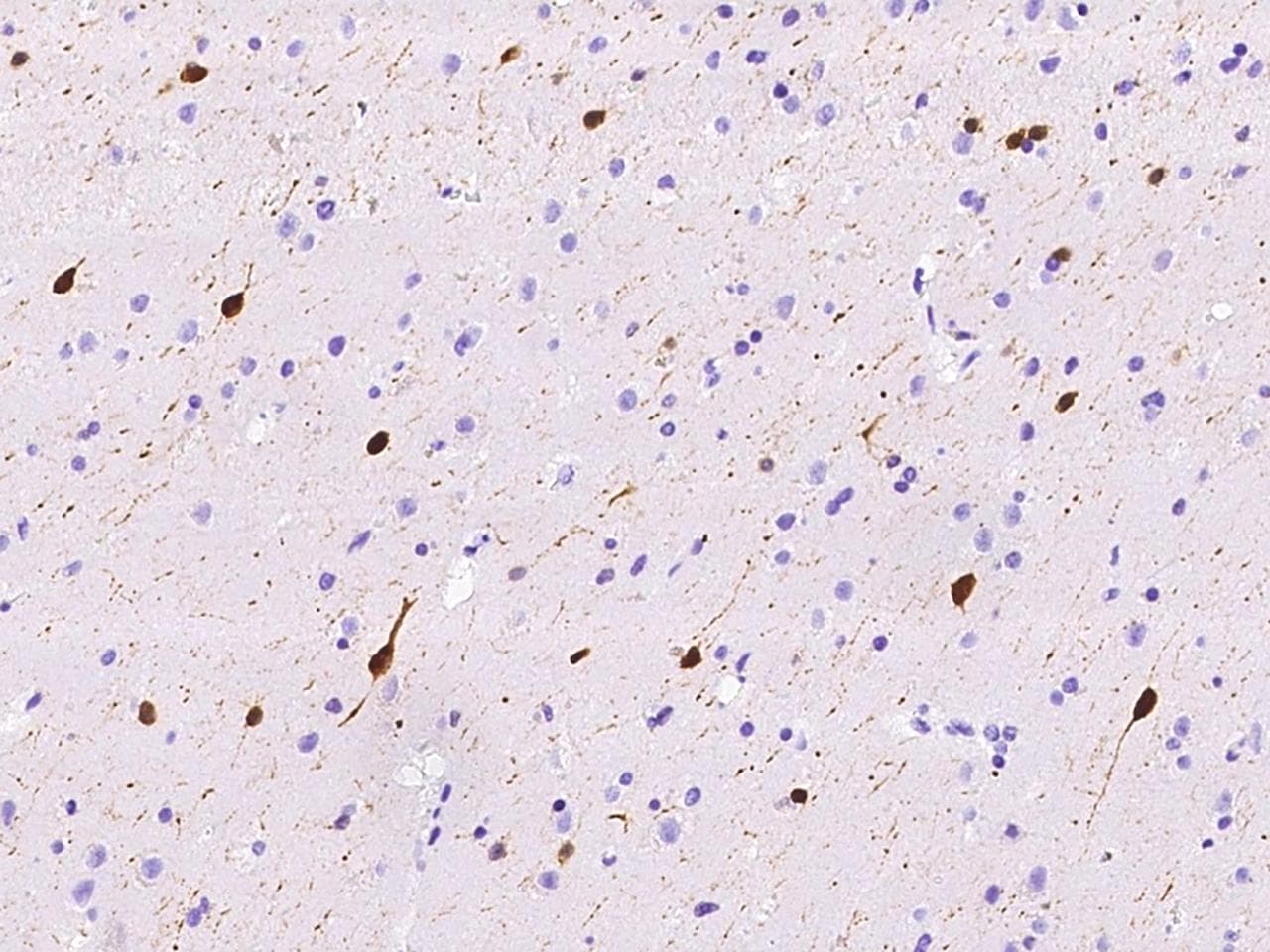 CALB2 / Calretinin Antibody