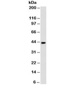 Monoclonal Mouse anti-Human MAGEA1 / MAGE 1 Antibody (clone MA454, IHC, IF, WB)