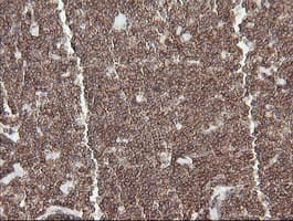 DEF6 Antibody (clone OTI3B2)