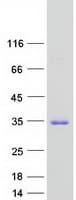 Human TTC9B Protein (Recombinant Myc-DDK (Flag))